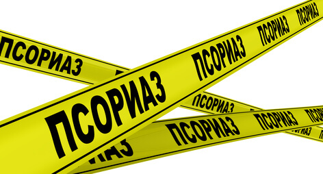 Псориаз кожи