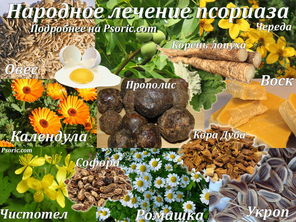 Народное лечение псориаза