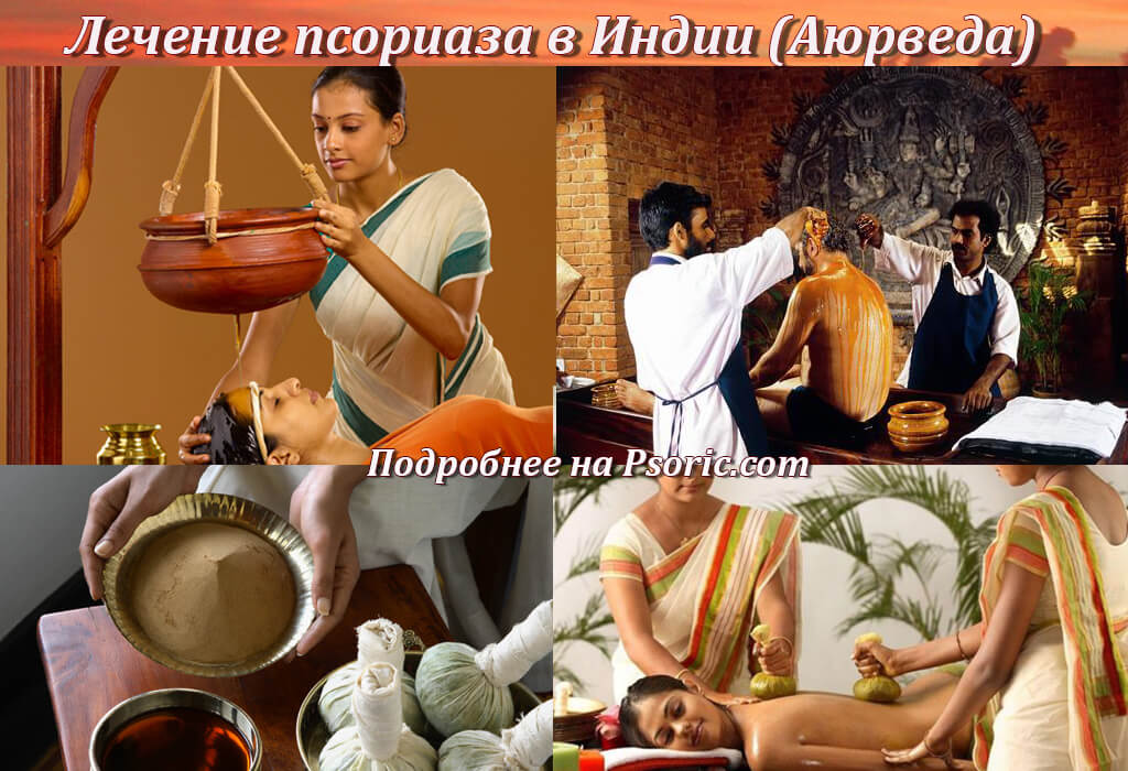 Аюрведа, лечение псориаза в Индии