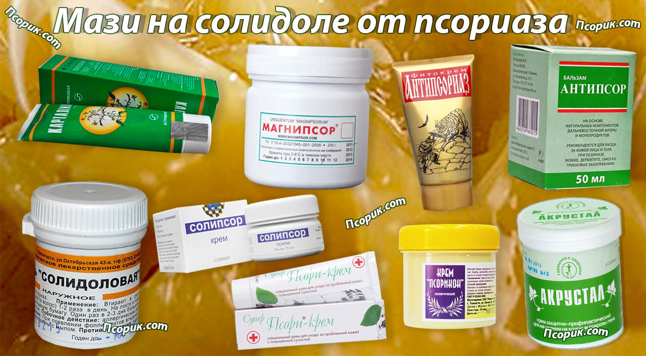Мази на солидоле от псориаза