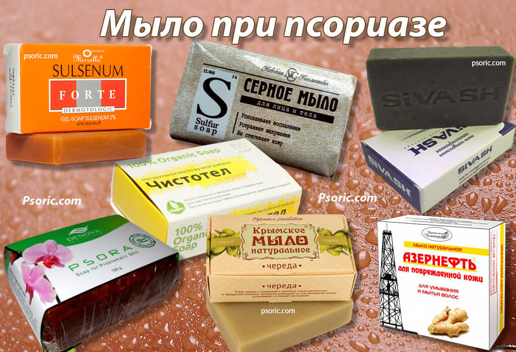 Мыло от псориаза